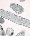 Pseudomonas aeruginosa-bakterie