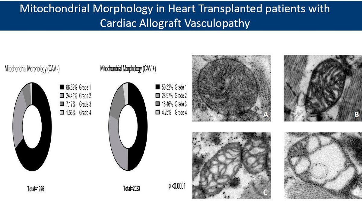 Mitochondrial Morphology in Heart Transplanted patients with Cardiac Allograft Vasculopathy