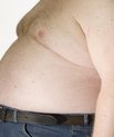 Obesity can lead to high cholesterol. New research results from Aarhus University shows a new way for cholesterol treatment.