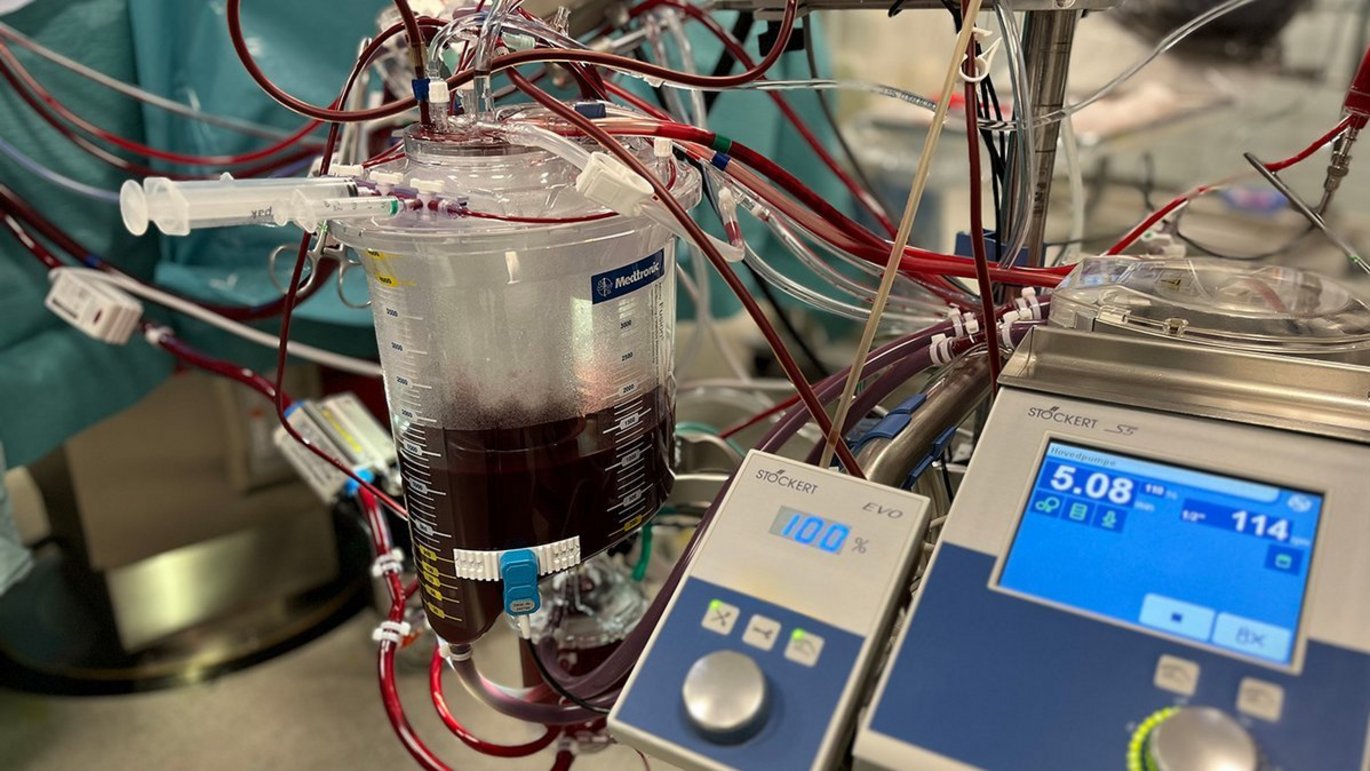 A perfusionist is responsible for the heart-lung machine, which maintains the patient’s circulation and oxygenation during open-heart surgery.