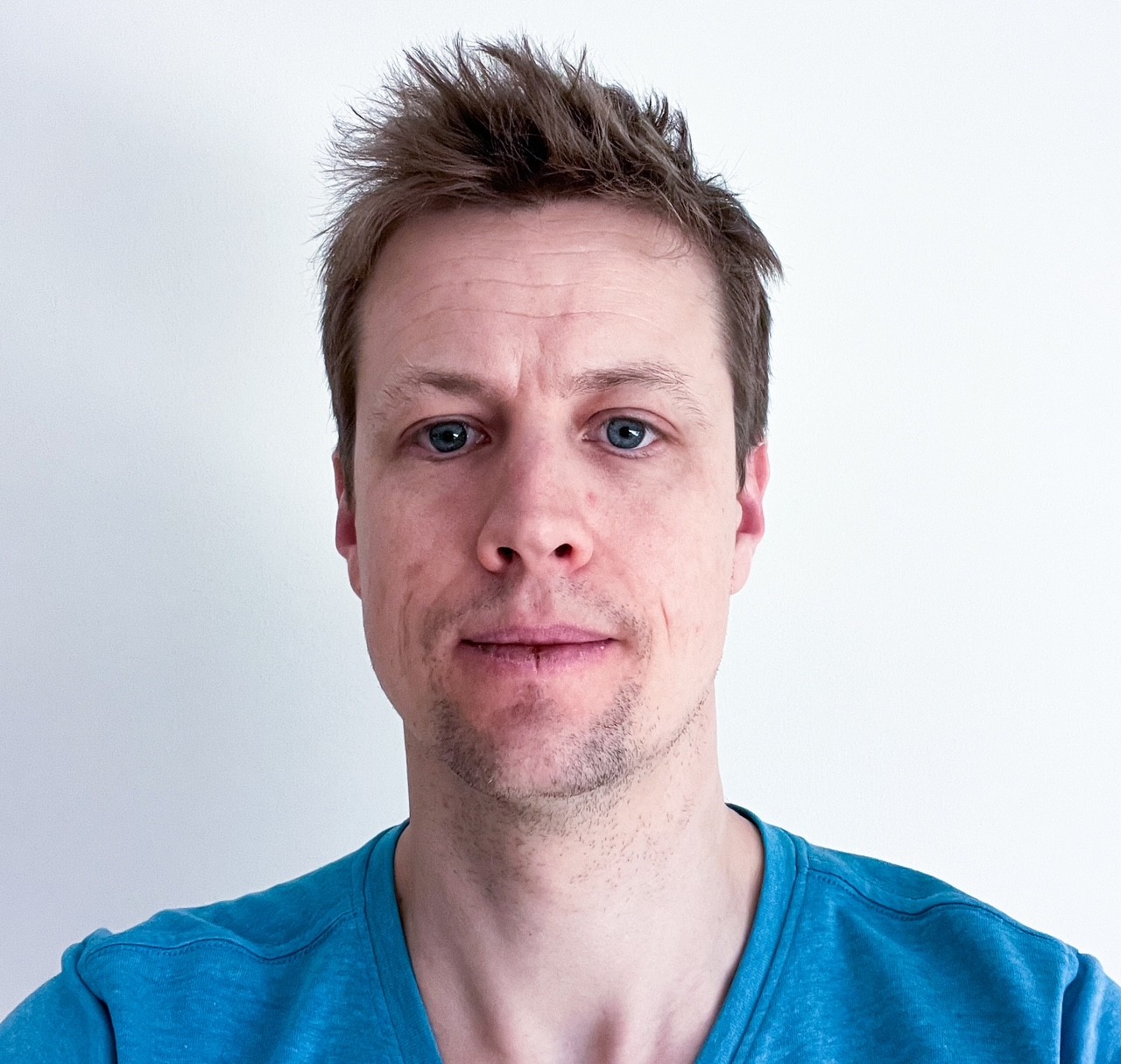 Jakob Kirkegård er ny doktor i kirurgisk behandling af bugspytkirtelkræft og tilknyttet både Institut for Klinisk Medicin og Afdeling for Mave- og Tarmkirurgi på Aarhus Universitetshospital. Jakob Kirkegård er ny doktor i kirurgisk behandling af bugspytkirtelkræft og tilknyttet både Institut for Klinisk Medicin og Afdeling for Mave- og Tarmkirurgi på Aarhus Universitetshospital.