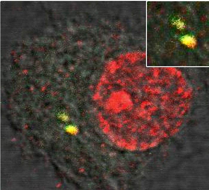 [Translate to English:] Her ses hvordan en celle med forsvarsproteinet (rød farve) fanger hiv uden for cellens kerne (gul farve). Dette bevirker, at cellens forsvarssystem aktiveres og efterfølgende blokerer hiv-infektionen.