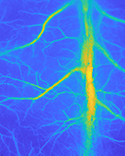 Image of laser speckle